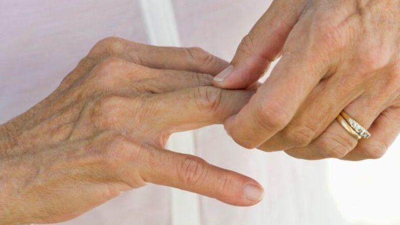 In cui le malattie hanno fatto male alle articolazioni delle dita